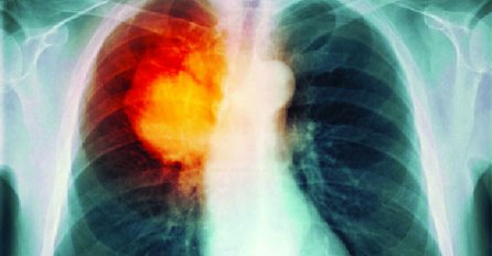 NAUČNICI OTKRILI RAZLOG: Evo zašto neki pušači DOŽIVE 100 GODINA, a neko UMRE sa 50 a NIKAD NIJE PUŠIO!