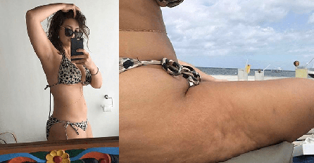 ONA NA INSTAGRAMU IMA SAVRŠENO TIJELO, A UŽIVO KATASTROFA: Celulit na sve strane, ova slika je tek početak!