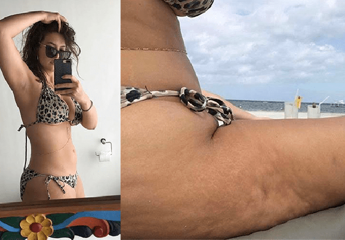 ONA NA INSTAGRAMU IMA SAVRŠENO TIJELO, A UŽIVO KATASTROFA: Celulit na sve strane, ova slika je tek početak!