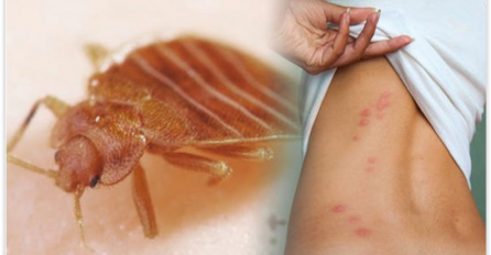 TURISTA U APARTMANU U TUČEPIMA UNAKAŽEN: Primjetio crvene ugrize po tijelu, pa pobjegao glavom bez obzira kad je shvatio u čemu je riječ