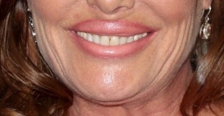 'KAKAV JE OVO UŽAS NA LICU', NIKO NE MOŽE DA JE PREPOZNA: Bila je najljepša, a danas živi u brdima da je niko ne vidi