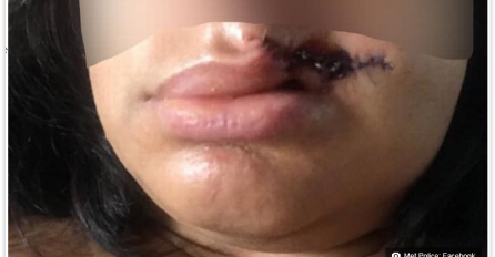 'NJEZIN ŽIVOT NAKON OVOGA NEĆE BITI ISTI' Djevojku na popularnom festivalu zaskočio nabildani tip, predstavio se kao Sotona pa je divljački izgrizao