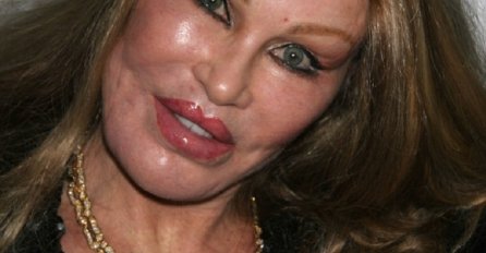 ZOVU JE "ŽENA MAČKA", UNIŠTILA JE LICE OD PLASTIČNIH OPERACIJA: Sada je isplivala njena slika prije OPERACIJA, niko ne može vjerovati!