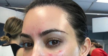 KIM KARDASHIAN BOLUJE OD TEŠKE BOLESTI, SKINULA ŠMINKU I POKAZALA KAKO JOJ LICE IZGLEDA: Donji dio slike je tužan!