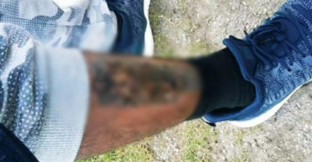 ŠTA RADE JADNIM LJUDIMA! Hrvatska POLICIJA ŽIGOSALA MIGRANTE  vrućim željezom, pa ih vraćala u BiH?!