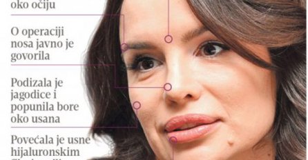 PJEVAČICE POD LUPOM PLASTIČNOG HIRURGA: Na Severininom licu sve je vještačko!
