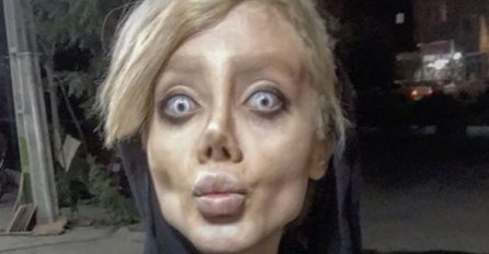 SJEĆATE SE DJEVOJKE KOJA SE UNIŠTILA OPERACIJAMA DA LIČI NA ANĐELINU DŽOLI? Sada su o njoj stigle LOŠE VIJESTI!