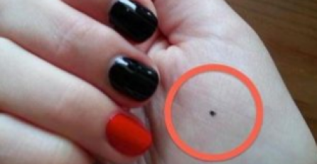 MISTERIOZNA CRNA TAČKA NA DLANU: Policija se pojavila na vratima ove žene kada je nacrtala nešto na svojoj ruci…