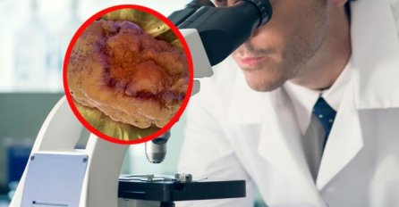 DOKTOR ŠOKIRAO CIJELI SVIJET! Vježbanje i šetnja su ŠTETNI, ako želite da živite DUGO  onda UŽIVAJTE  U ŽIVOTU OVAKO!