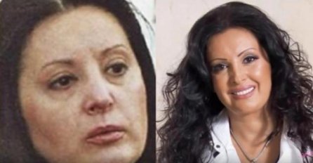 TVRDI DA NIJE IMALA OPERACIJE A SADA ISPLIVALE SLIKE, DRAGANA MIRKOVIĆ NEPREPOZNATLJIVA: Tek da joj vidite ZUBE, pa ovo je HIT!