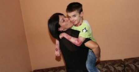 SVAKI MINUT U  BOLOVIMA I KRATAK ŽIVOTNI VIJEK : Sve o buloznoj epidermolizi, teškom oboljenju od kojeg je preminuo DJEČAK LEPTIR! TUGA DO NEBA!