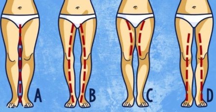 Oblik vaših nogu otkriva kakve ste u LJUBAVNOJ VEZI: Ovaj TIP svaki muškarac želi, JESTE LI TO BAŠ VI - ODMAH PROVJERITE