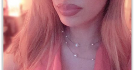 RADA MANOJLOVIĆ UNAKAŽENA! Otišla kod estetskog hirurga da poveća usne pa završila OVAKVA! Šta je ovo radila od sebe?!