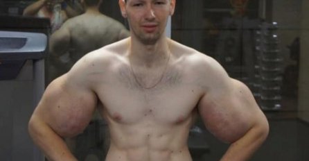 NEMOJ SE VIŠE BRUKATI Ruski Popaj ubrizgava opasnu supstancu u mišiće. U prvom meču ponizio ga je amater!