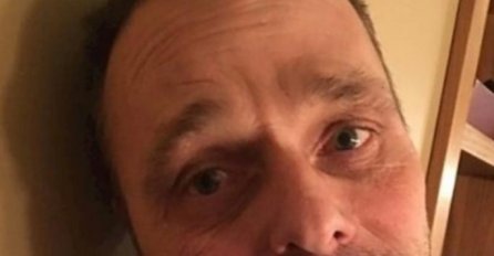 KUPIO JE NAVLAKU ZA ZUBE DA BI IMAO LJEPŠI OSMIJEH: Sad plače od MUKE a internet VRIŠTI OD SMIJEHA! (FOTO)