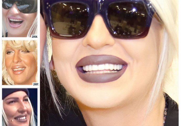 OVAKO SU NAŠE POZNATE LIČNOSTI IZGLEDALE PRIJE NEGO SU URADILE ZUBE: Kad vidite CECU, smijat ćete se danima, ŠTA JE OVO (FOTO)