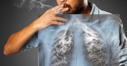 "U životu sam dosta gubio. Gubio sam djevojke, šanse, posao i zbog svega toga izgubio i zdravlje, ali sam najtežu i najvažniju bitku dobio jer sam pobijedio rak pluća. "