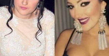 ROĐENA MAJKA IH NE BI PREPOZNALA: Evo kako su estradne ličnosti izgledale prije PLASTIČNIH OPERACIJA! KARLEUŠA JE HIT!