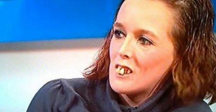 ZVALI SU JE ŽENA S KONJSKIM ZUBIMA: Sada ne liči na sebe, transformacijom je UŠUTKALA SVE! Šta vi kažete?! 