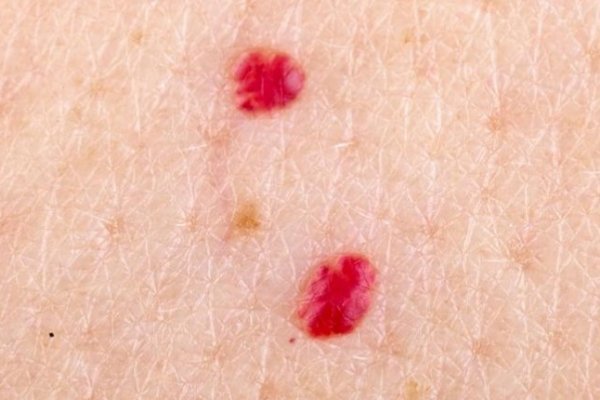 5ac54660-5678-4b25-9e17-046e0a0a0a67-tackice-preview