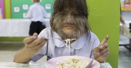 BILA JE NAJDLAKAVIJA ŽENA SVIJETU, OBRIJALA JE LICE PA SE UDALA: Kad vidite kako danas izgleda, ZANIJEMIT ĆETE!