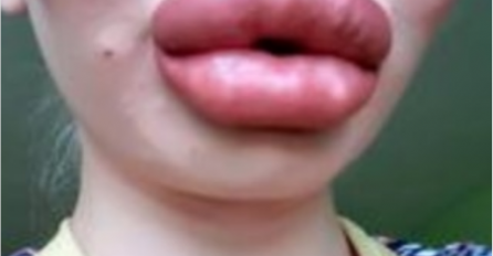 ŠTA URADI OD SEBE?! Voditeljica  POVEĆALA USNE! Kada vidite kako sada izgleda, POVRAĆAT ĆETE OD MUKE!