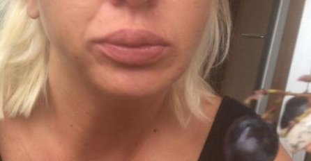 BEZ ŠMINKE I PHOTOSHOPA NE LIČE NA SEBE: Ovako zaista izgledaju domaće zvijezde! CECINA SLIKA ŠOKIRA, ZAR JE OVO ONA ISPOD PUDERA? (FOTO)