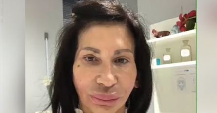 ZA SNEŽANU IZ BEOGRADA KAŽU DA JE NAJVEĆI PROMAŠAJ PLASTIČNE HIRURGIJE: A evo kako je izgledala prije svih OPERACIJA! PRIJE VELIKIH USANA I SILIKONA (FOTO)