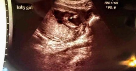 BILA SAM NA ULTRAZVUKU U 16. SEDMICI TRUDNOĆE: Kad su mi rekli šta nosim, SRCE MI JE POTONULO, morala sam to da krijem od svih