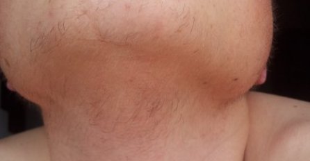 ŽENE, IMATE LI DLAKE NA BRADI? Ovo je opasan problem, EVO ZAŠTO SE JAVLJAJU! IMATE OVO OBOLJENJE