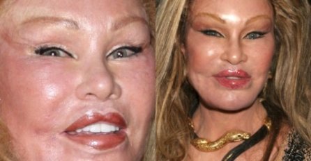 ZOVU JE "ŽENA MAČKA, UHVATIT ĆETE SE ZA GLAVU KAD VIDITE NJENE SLIKE PRIJE PLASTIČNIH OPERACIJA: Niko ne može vjerovati!