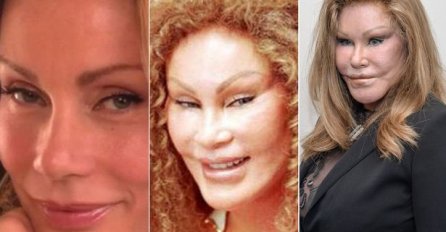 PRIJE VIŠE OD 30 GODINA POČELA JE SA PLASTIČNIM OPERACIJAMA DA BI UDOVOLJILA MUŽU: Danas je izobličena, A BILA JE TAKVA LJEPOTICA, čekajte dok vidite sliku (FOTO)