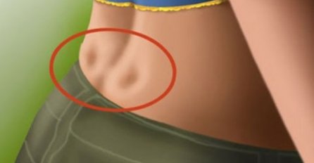 IMATE LI OVAKVE DVIJE RUPICE NA LEĐIMA? Evo šta to govori o VAŠEM ZDRAVLJU, nismo imali pojma!