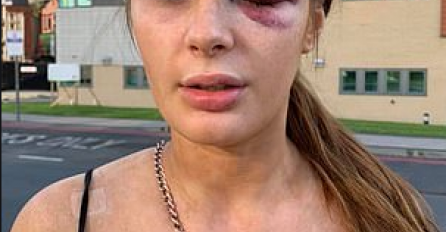 "Moj otac me je toliko kroz život tukao da od njega imam razne ožiljke po tijelu uključujući glavu."