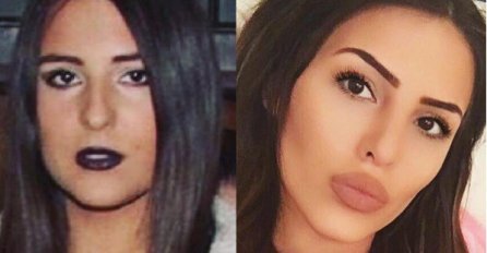  SRBIJA NA NOGAMA ZBOG OVIH SLIKA PRIJE OPERACIJE, CECA IH ZABRANILA U JAVNOSTI: Ovako je nekada izgledala Anastasija, ISTA ARKAN! 