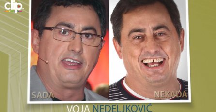 DANAS BISERI, A NEKADA... OVAKO SU NAŠE POZNATE LIČNOSTI IZGLEDALE PRIJE NEGO SU URADILE ZUBE: Kad vidite KARLEUŠU I CECU SMIJAT ĆETE SE DANIMA (FOTO)