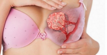 RAK DOJKE NASTAJE ZBOG OVOG NAPITKA KOJI PIJEMO SVAKI DAN, SADA JE SVE DOKAZANO: Ne ignorišite, MOŽETE SPASITI ŽIVOT NEKOME!