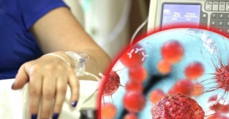 OPREZ, RAK NIJE PRVA BOLEST, OVO SE PRIJE NJEGA JAVLJA: Spriječite karcinom na vrijeme, spasite VAŠ ŽIVOT ILI ŽIVOT BLIŽNJIH!