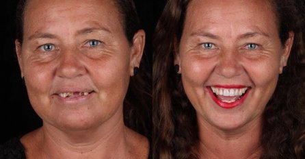 BILI SU SIROMAŠNI I BEZ ZUBA, A ONDA IM JE JEDAN ZUBAR UGRADIO PROTEZE: Nećete vjerovat svojim očima kad vidite POSLJEDNJU SLIKU!