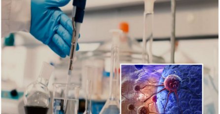 NJEMAČKI NAUČNIK ZAPREPASTIO SVE: Rak se dobija od ove DVIJE NAMIRNICE, da su znali ljudi još bi bili živi!