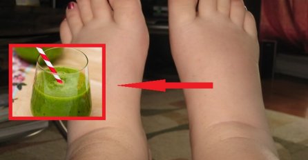 OTIČU LI VAM NOGE NA VRUĆINI? EVO ŠTA JE U PITANJU: Samo je jedan UZROK i lako se može spriječiti