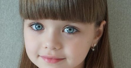 PRIJE 3 GODINE JE BILA NAJLJEPŠA DJEVOJČICA NA SVIJETU: Sad su je uslikali i niko ne vjeruje DA OVAKO IZGLEDA, NEMOGUĆE! (FOTO)