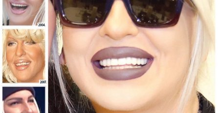 OVAKO SU NAŠE POZNATE LIČNOSTI IZGLEDALE PRIJE NEGO SU URADILE ZUBE: Kad vidite CECU, smijat ćete se danima, ŠTA JE OVO (FOTO)