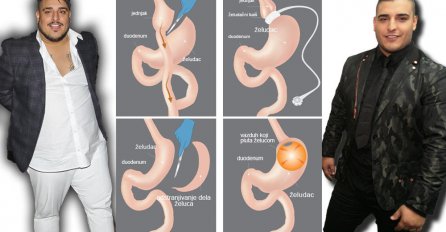 OVAKO SADA IZGLEDA ŽELUDAC DARKA LAZIĆA: Procurili su svi detalji OPERACIJE,"Prošao je pakao.."! (FOTO)