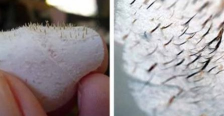 MITESERI SAMI ISPADAJU IZ PORA: Uz ova DVA sastojka koja već imate u kući OČISTITE LICE DO SAVRŠENSTVA!