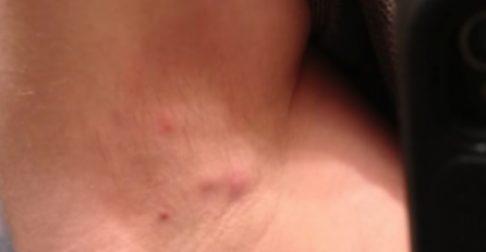 POJAVILA VAM SE OVAKVA IZRASLINA ISPOD PAZUHA: Evo šta to znači, OVO MORATE ZNATI