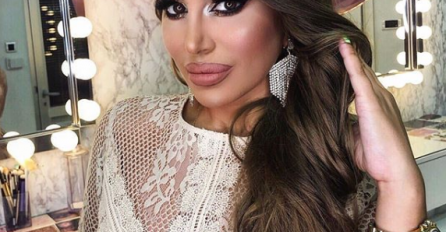 PREPAST ĆETE SE KADA VIDITE KAKO JE DALILA IZGLEDALA PRIJE OPERACIJA, OVAKVA NIJE MOGLA NI NA SELO! Kukasti nos, tanka kosa, a tek usne..HIT SLIKE!