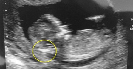 KAD SAM RODILA KĆERKU PLAKALA SAM KAO KIŠA, LJEKARI SU MI REKLI DA JE SE ODREKNEM: A evo kako ona izgleda 15 godina kasnije, MNOGI SE RASTOPE KAD JE VIDE