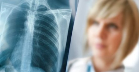 OVO SU SIMPTOMI UPALE PLUĆA KOJE NE SMIJETE ZANEMARITI: Nije samo kašalj u pitanju, DA LI VAM SE OVO JAVLJA?