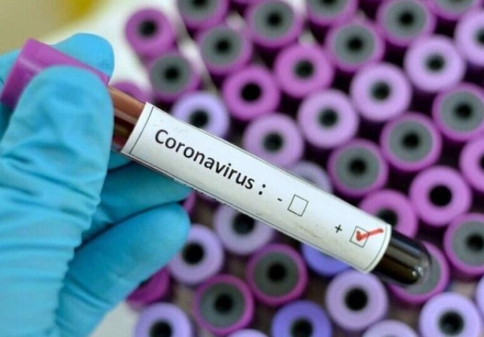 U BiH 1.000 osoba zaraženih koronavirusom